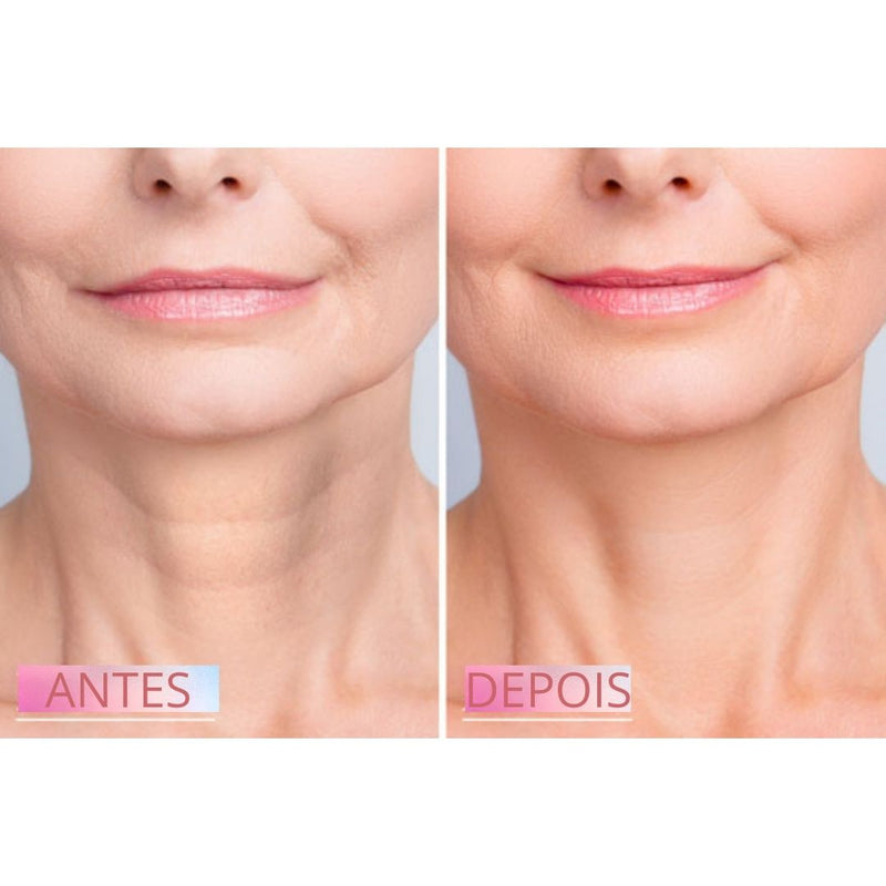 Adesivo Anti Rugas Reutilizável para Pescoço - Full Lift